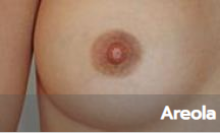 galerie-areola