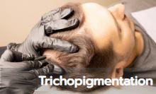 gallery-trichopigmentation
